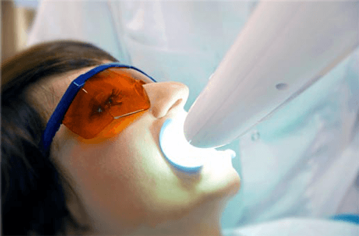 Understanding the Causes of Teeth Sensitivity Henley