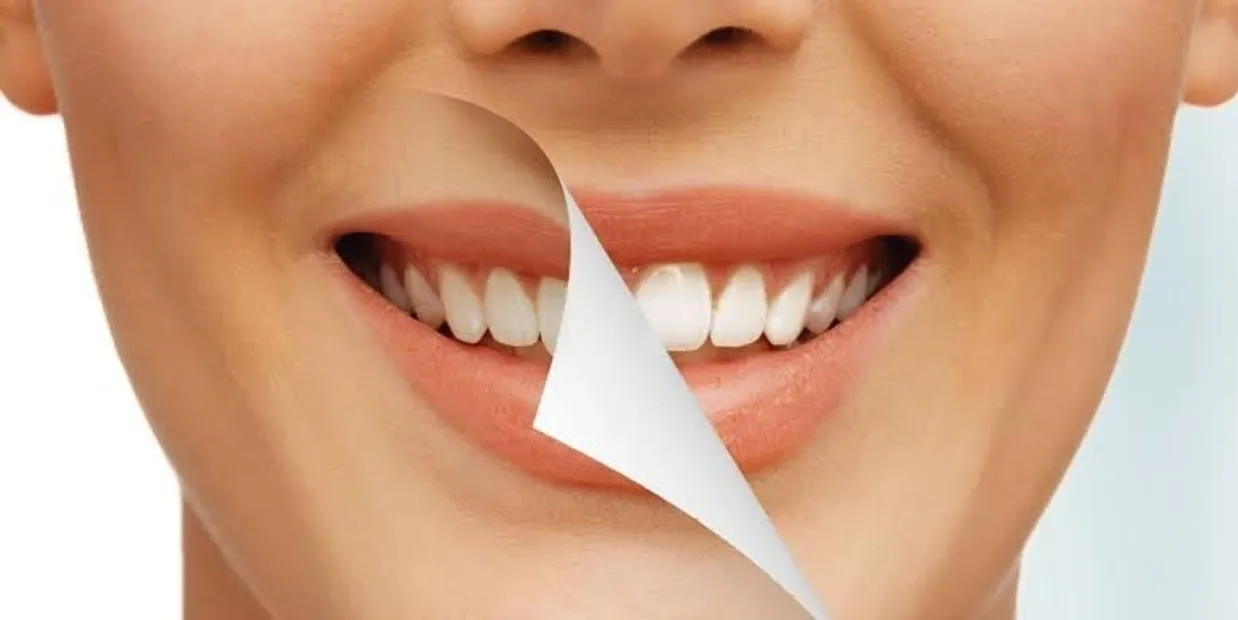 Can Laser Teeth Whitening Damage Your Dental Crowns Henley?