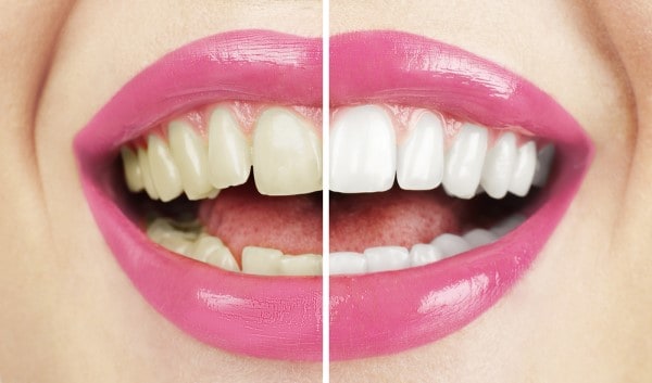 What Early Signs of Oral Cancer Should You Never Ignore Henley?
