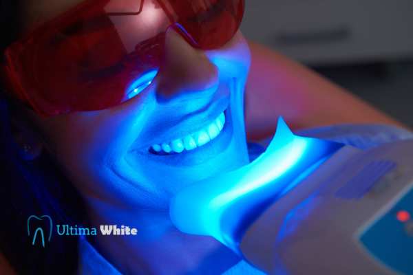 Professional Teeth Whitening Options Henley
