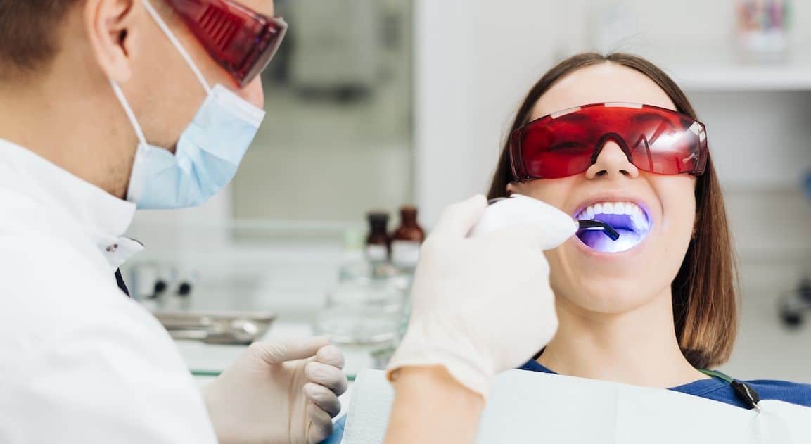 Do Dental Crowns Change Colour After Teeth Whitening Henley?