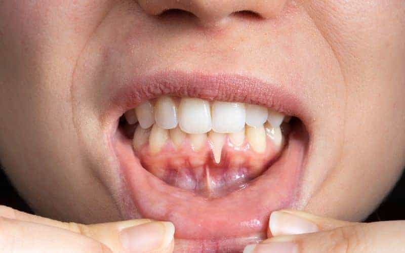 Final Thoughts: Building Lifelong Enamel Protection Habits Henley