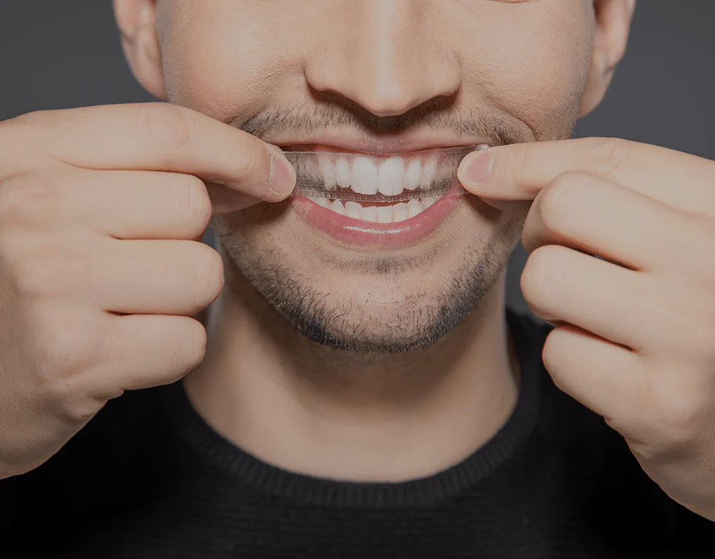 How Are Invisible Aligners Changing Orthodontic Treatments Henley?