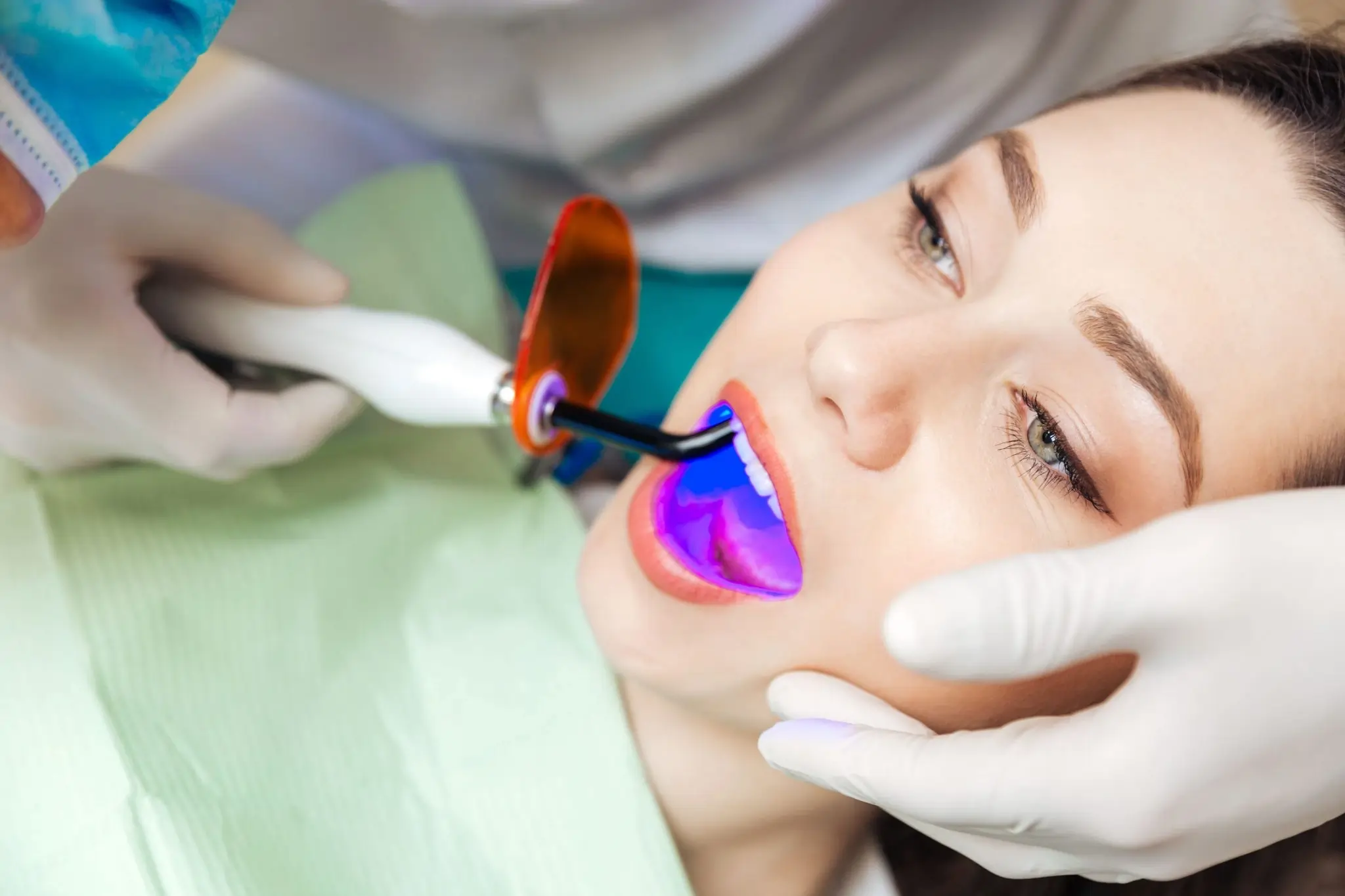 Is Laser Teeth Whitening Safe and Effective Henley?