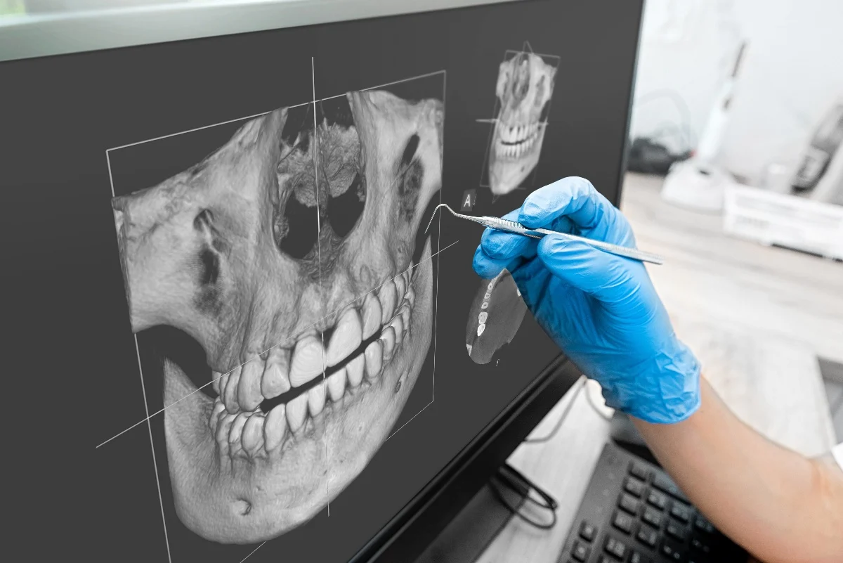 Key Benefits of 3D Printing for Patients and Dentists Henley