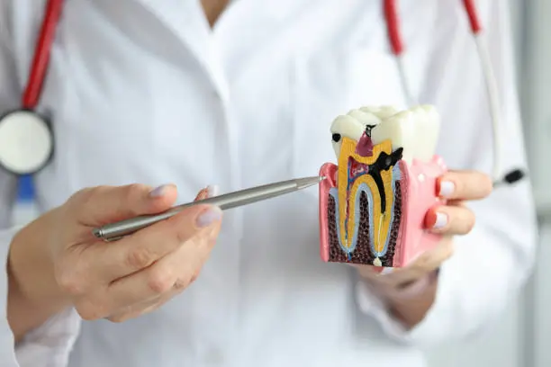 The Silent Culprits: Common Habits That Damage Your Teeth Henley