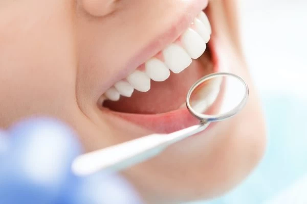 How Do You Choose the Right Cosmetic Dentist Henley?