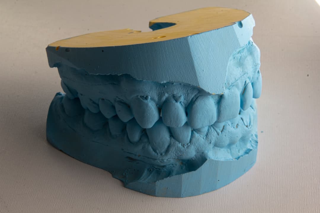 How Do Dental Implants Improve Jawbone Health and Oral Function Henley?
