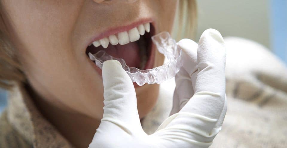 Can Bruxism Affect Your Sleep Quality Henley