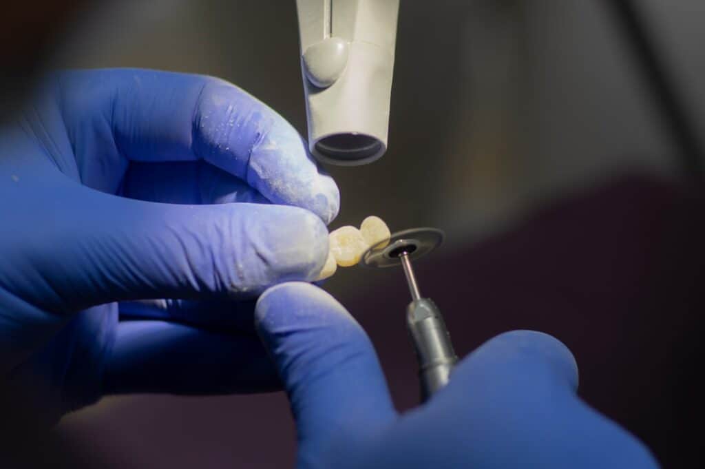 Customised Dental Solutions: Crowns, Aligners, and Implants Henley