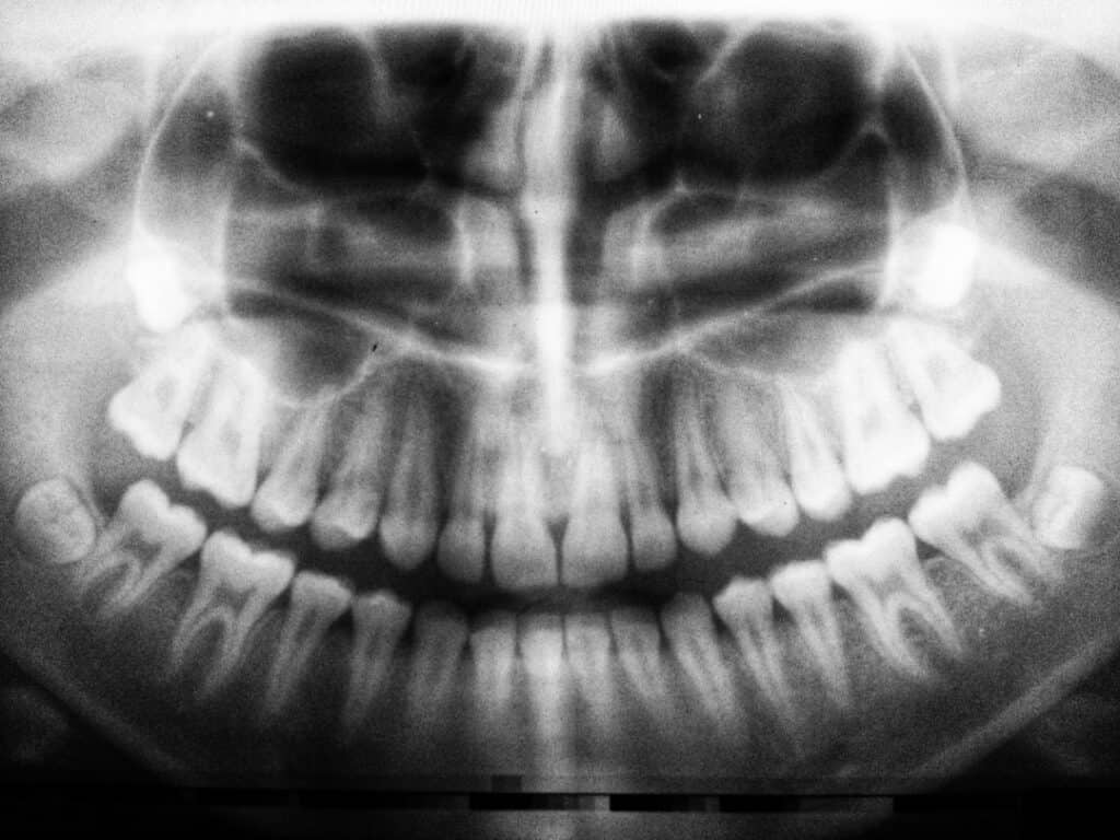 The Future of 3D Printing in Oral Healthcare Henley