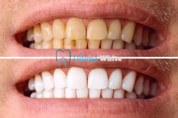 Stained Teeth and Persistent Bad Breath Henley